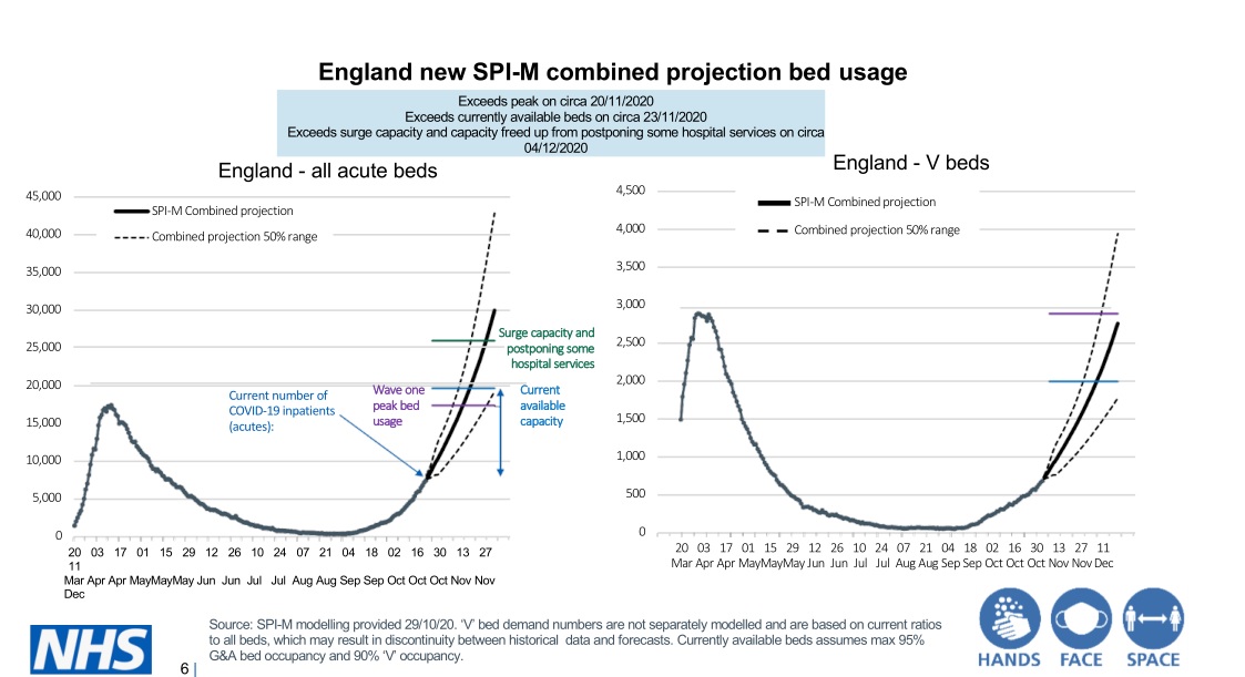 Vallance complicated slide